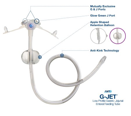 Applied Medical Technologies GJ-1420-30 Low Profile Button Gastrostomy / Jejunal Tube G-JET 14 Fr. 2 X 30 cm Tube