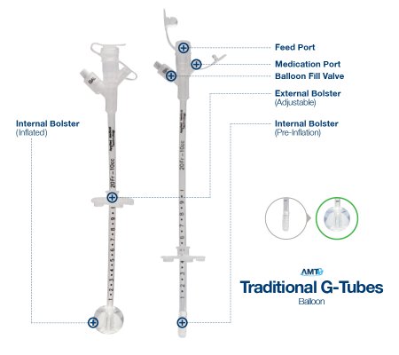 Applied Medical Technologies 7-1410 Gastrostomy Tube AMT 14 Fr. Adjustable up to 10cm Tube Silicone