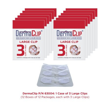 DermaClip US LLC  63004 Non-Invasive Skin Closure DermaClip 3 Inch X 21 mm Clear