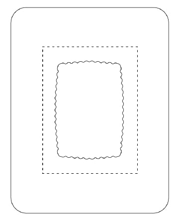 Medline  SV80XT Transparent Film Dressing with Pad SorbaView 2000 5 X 6-1/2 Inch Frame Style Delivery Rectangle Sterile