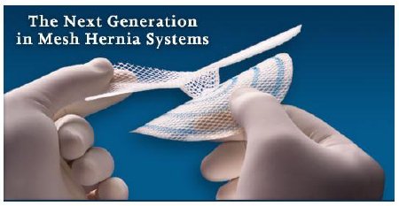 J & J Healthcare Systems  UHSM Hernia Repair Mesh Ultrapro Hernia System Partially Absorbable Polypropylene / Poliglecaprone-25 3 X 3 Inch Medium Style Undyed with Blue Striping Sterile