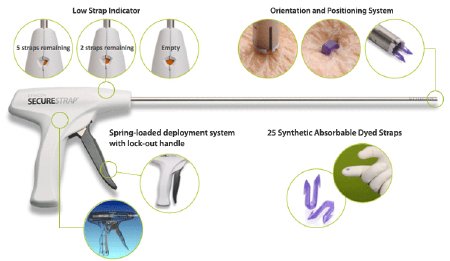 J & J Healthcare Systems  STRAP25 Laproscopic Fixation Device SECURESTRAP Pistol Grip Handle Polymer Blend Strap Absorbable Straps