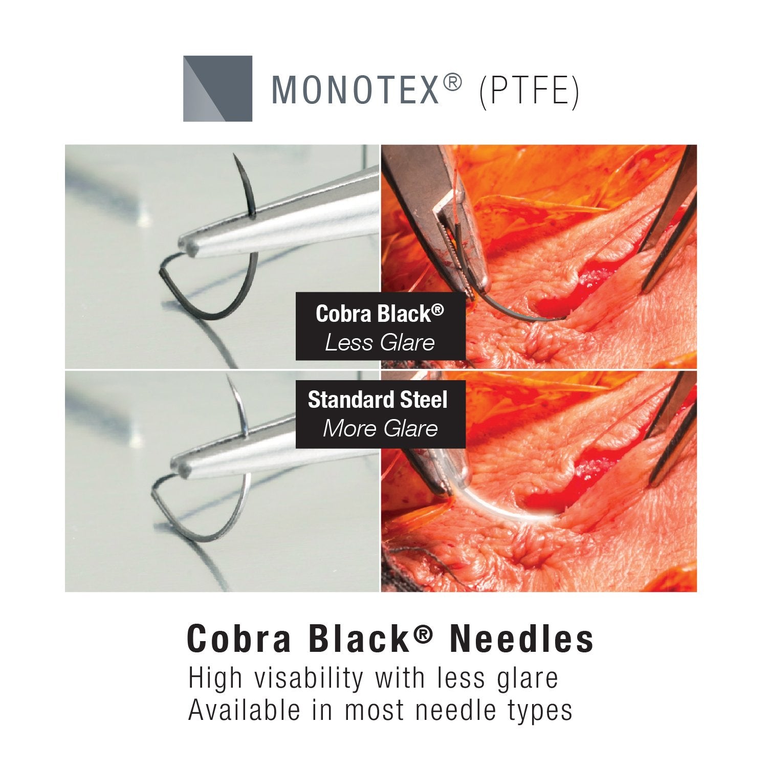 Monotex CorbraBlack PTFE Sutures Reverse Cutting Black Needle Box/12