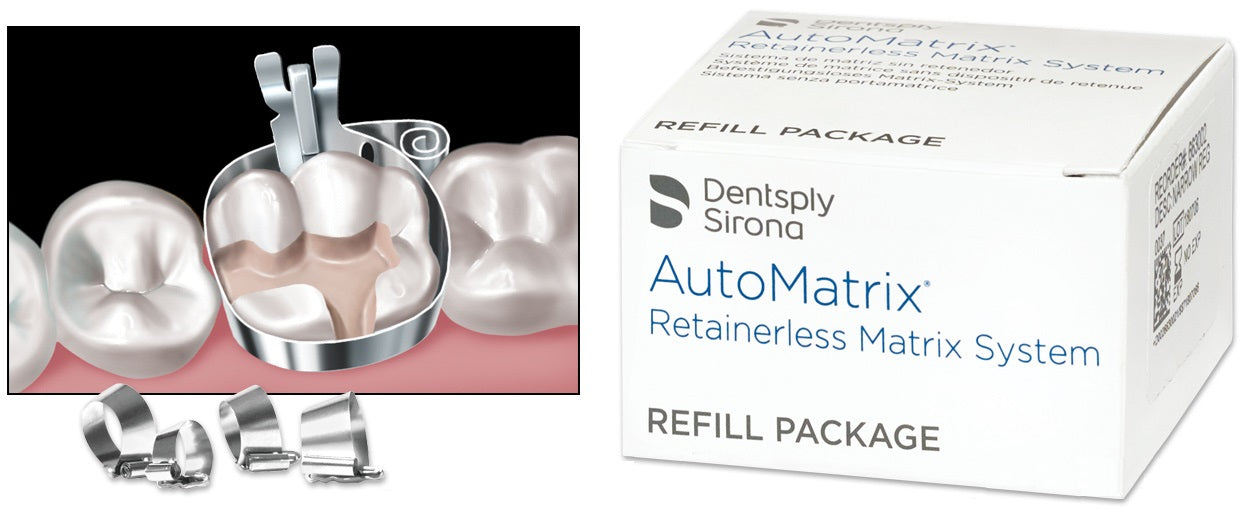 AutoMatrix Retainerless Matrix System Refill Box/72